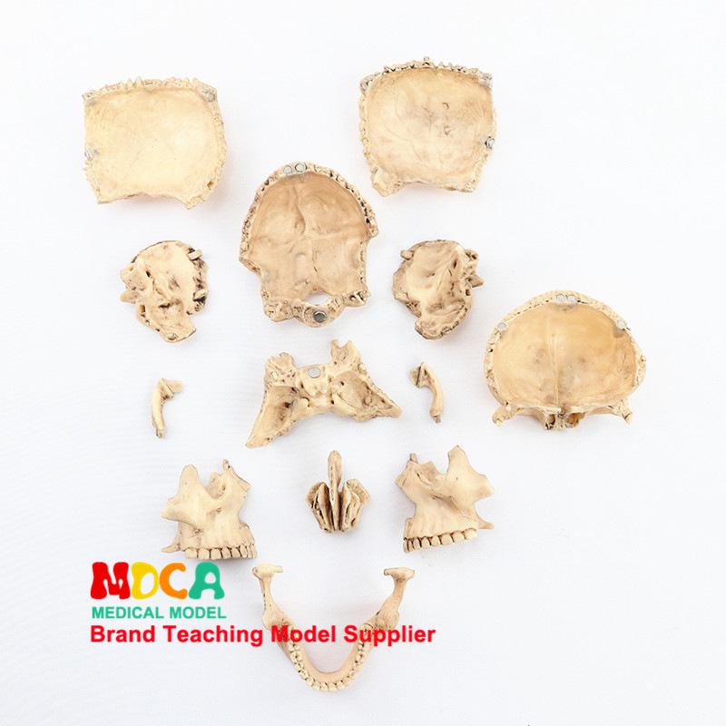 Medical 15-Part Detachable 1:2 Human Color Skull Model for Teaching