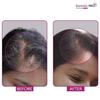 Bontress PRO+ Hair Growth Serum with Redensyl, Anagain, Capixyl, Procapil 30ml