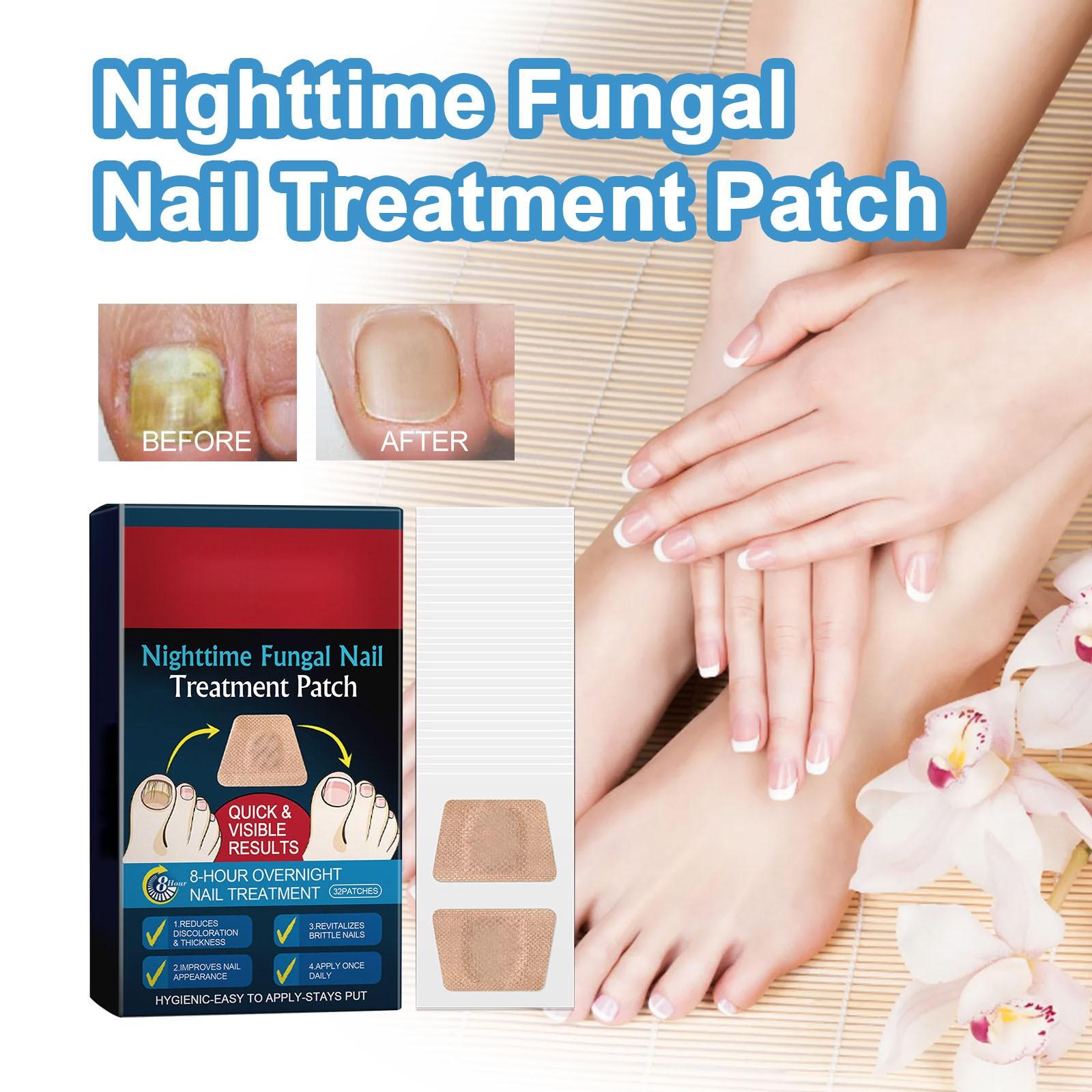 

Многофункциональные наклейки для ухода за ногтями, уход за поврежденными ногтями, эффективно улучшают внешний вид поврежденных ногтей на руках и ногах One Size