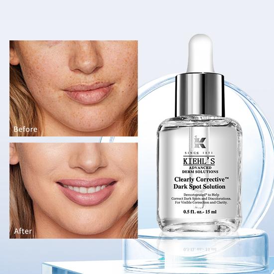 Clearly Corrective Dark Spot Serum – Reduziert Hyperpigmentierung und Akneflecken 0,5 FL.OZ/15ML