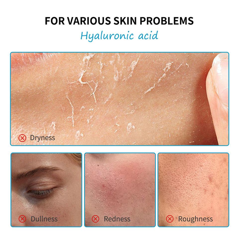 Hautpflege Mini-Set Reiniger Make-up Entferner Feuchtigkeitscreme & Augencreme zur Hydratisierung der Haut Flugzeugfreundliche Größen Hautpflegeset Anti-Falten Hautpflege