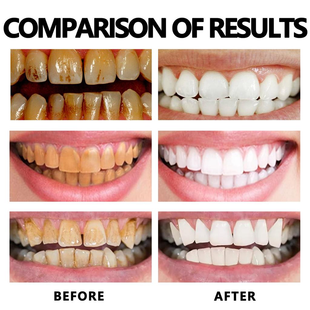 30ml Gumová pěnová pěna Čisté zuby Péče o zubní kámen Dásně Čisté zuby Proti zubnímu kazu Svěží dech Pěna