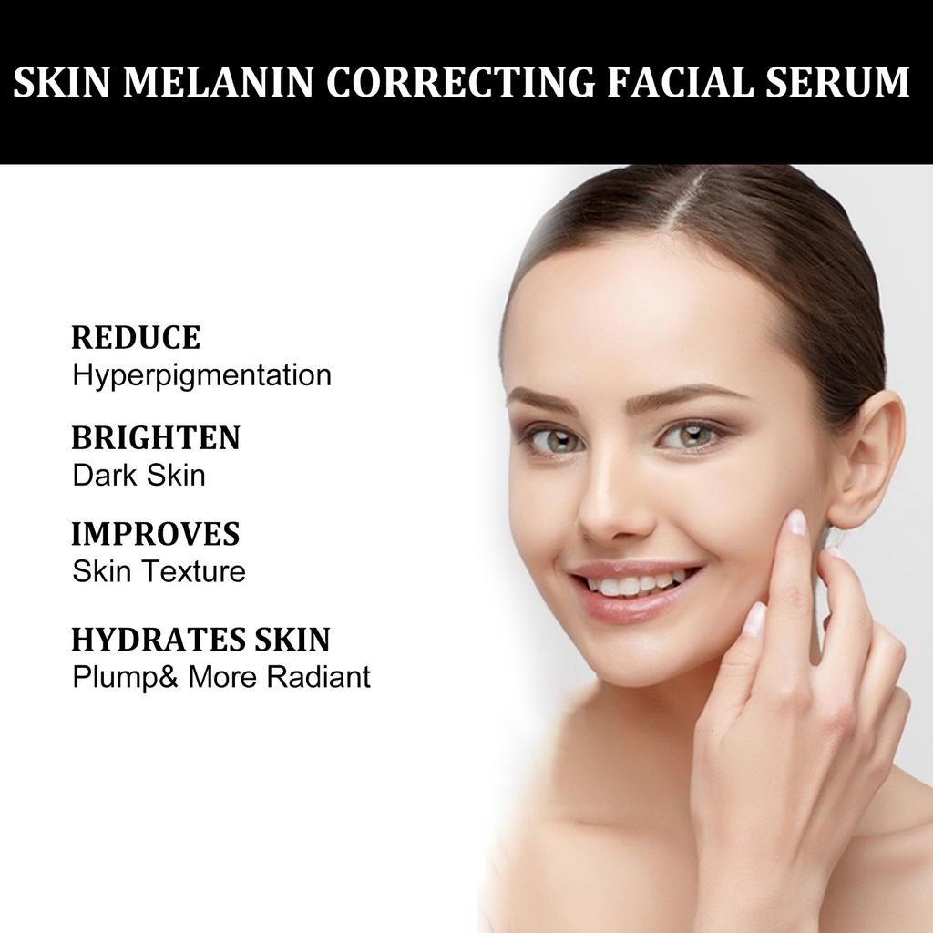 EELHOE Melanin Correcting Serum Fade Dark Spots Anti Freckle Melasma Remover Lightening Pigment Blemish Vitamin C Face Essence