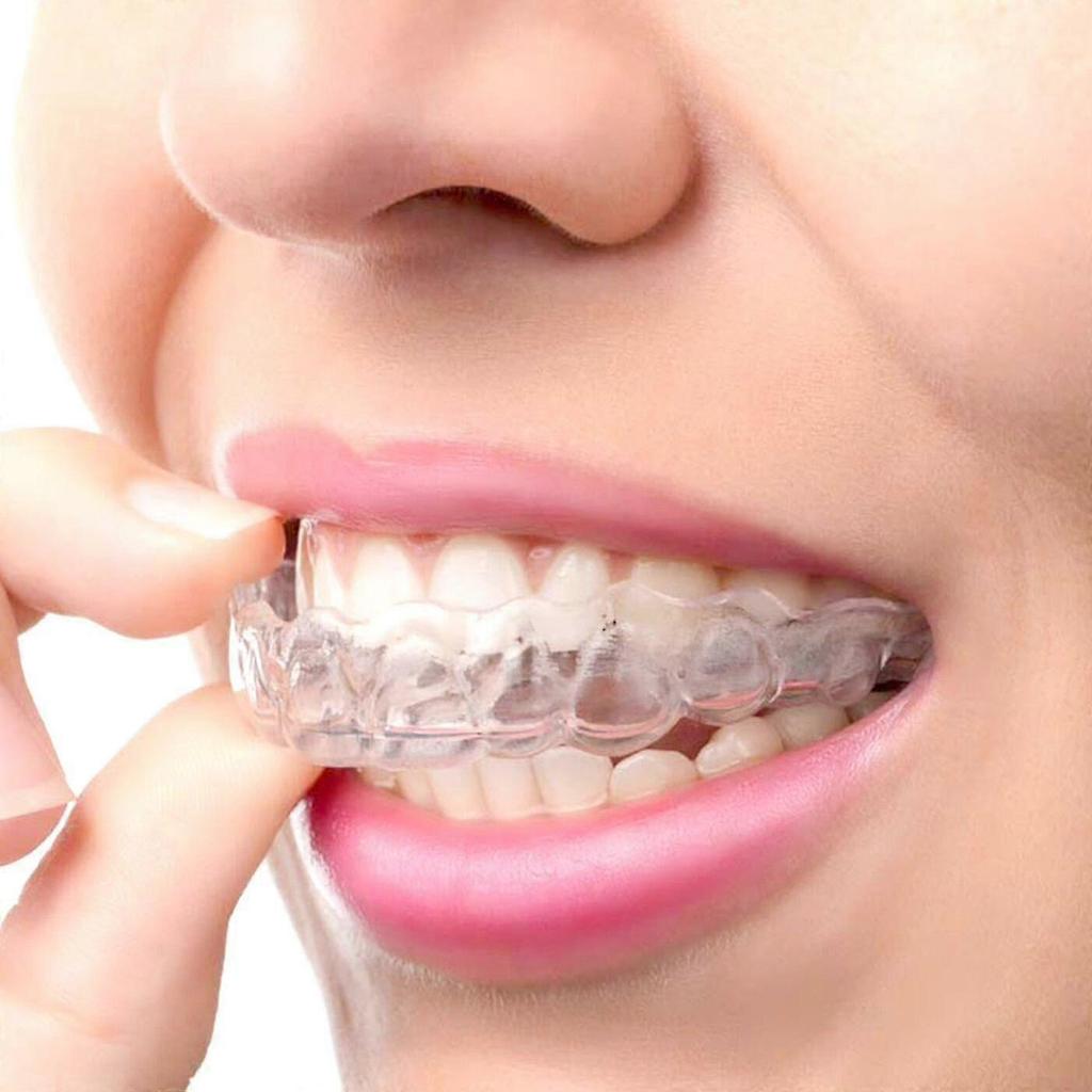 3 Pack Teeth Whitening Gel With Braces Shaping Invisible Braces Teeth Whitening Tool, Clear