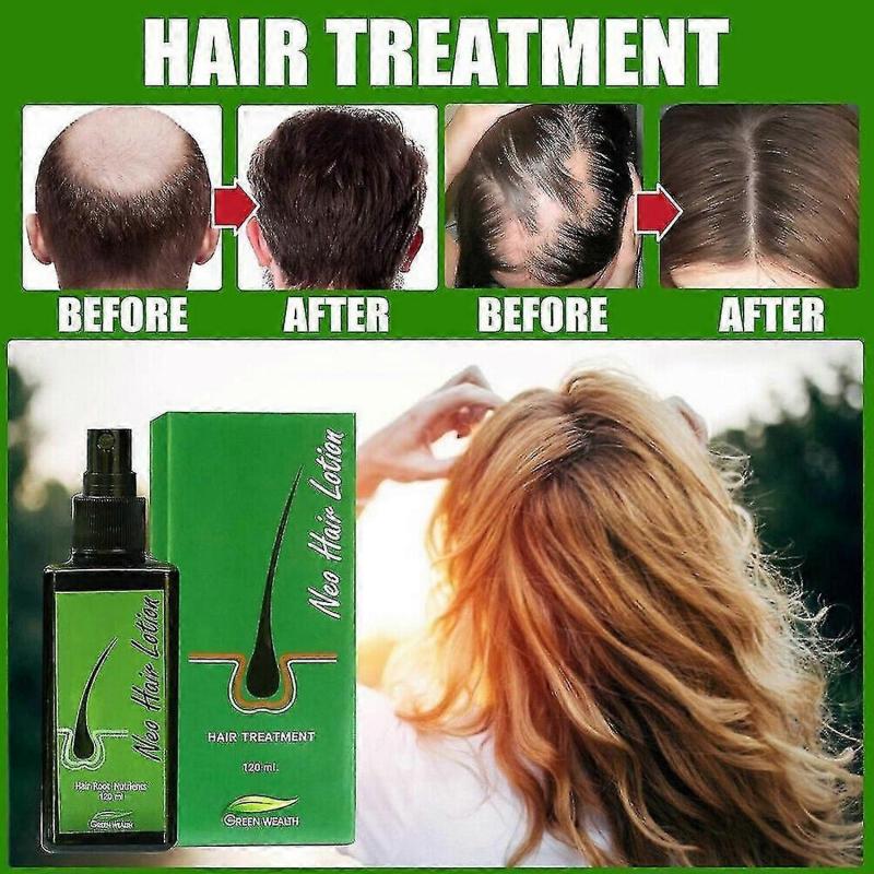 120ml Hair Lotion Green Wealth Growth Root Hair Loss Sideburns Treatment
