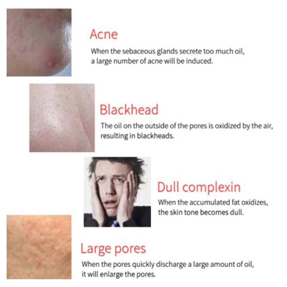 Face Oil Absorbing Roller Volcanic Stone Beauty Oil Rolling Removing For Women Face Ball Shiny V4P5