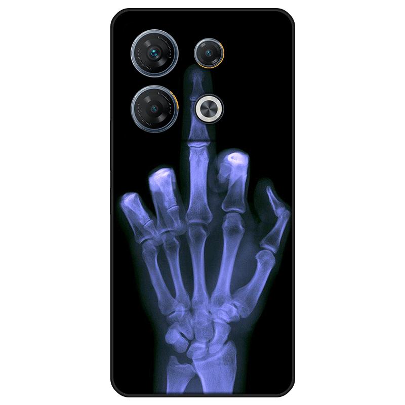 Für Infinix GT 10 Pro Gehäuse TPU lackierte Rückseite Infinix GT 10 Pro weiche Silikonhülle