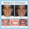 Denture Silicone Kit Soft Liners Upper Lower Teeth Set Easy Use Braces for Comfortable Fit