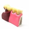 1 Pc Dental Teeth Common Pathologies Model Teaching Model Tooth Dentist for Medical Science Teaching Dental Communication Model