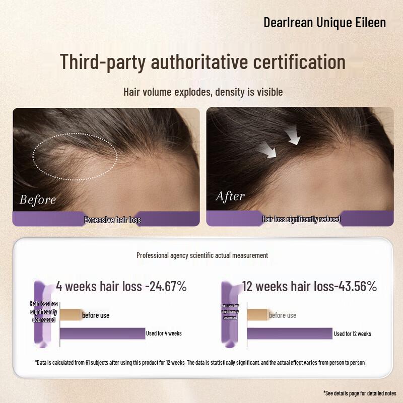Unique Aileen Gilded Dream Anti-Hair Loss Shampoo