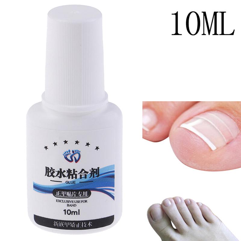 Buy 10ML Nail Glue Ingrown Toenail Correction Pedicure Toe Patch Foot