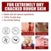 5 par eksfolierende fotmaske Fruktsyreforyngelse Fjern hard hud Skrubb Aha 30%+Bha 2% peeling Glatt fuktighetsgivende helse
