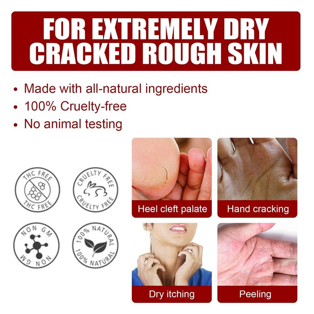 5 par eksfolierende fotmaske Fruktsyreforyngelse Fjern hard hud Skrubb Aha 30%+Bha 2% peeling Glatt fuktighetsgivende helse