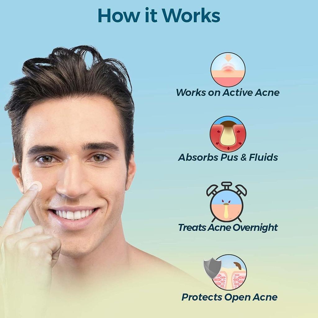 Spruce Shave Club Acne Pimple Patches for Face (72 Acne Patches for Pimples)