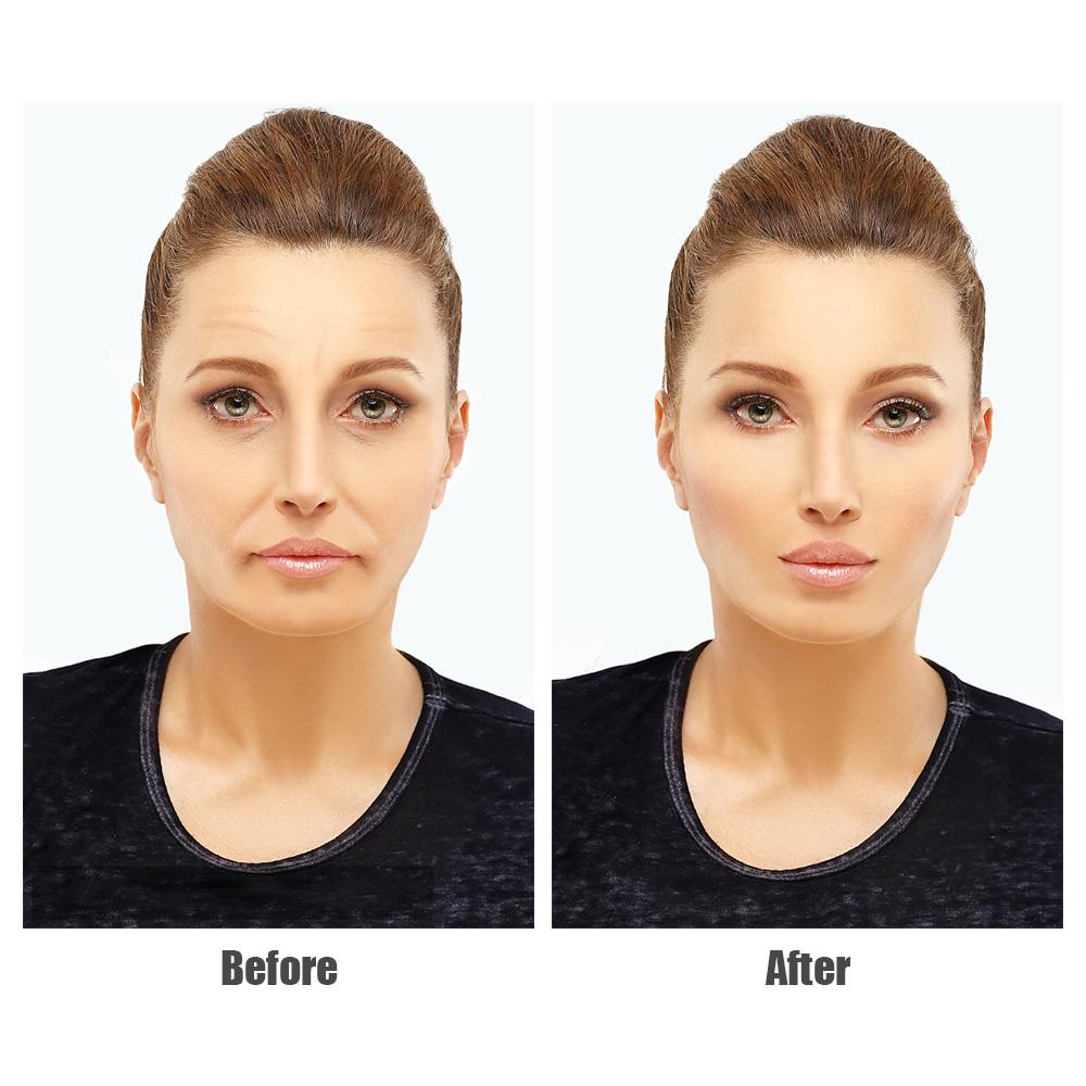 3-18Piece Set Anti-Wrinkle Stickers Women Reusable Silicone Removal Sticker Face Forehead Neck Pad Aging Skin Lifting Care Patch