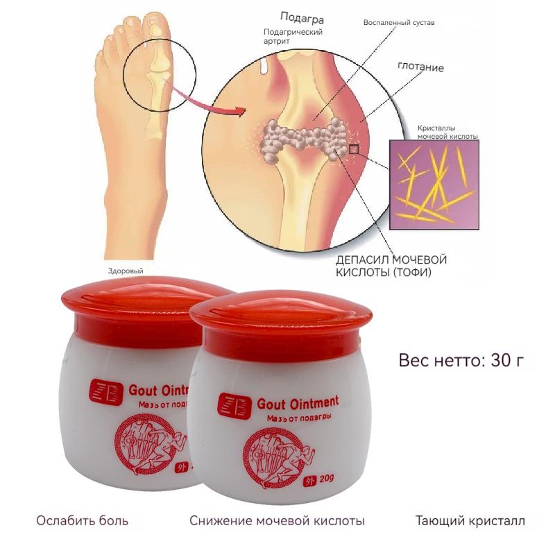 Bunions Care Cream Foot Care Cream For Painful Bunions Joint Pain Balm NO BOX 20g