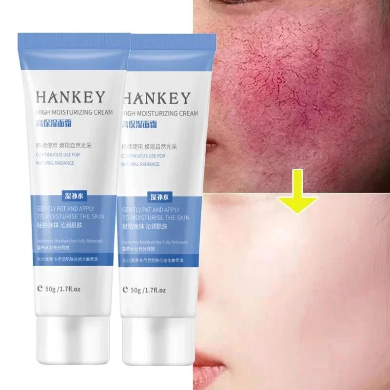 Crema Riparatrice Rossori Viso Lenitiva Pelle Sensibile Secchezza Idratante Lozione Idratante Rimozione Rosacea Cosmetici Coreani