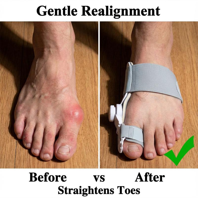 Hallux Valgus Pain Relief Splint - Professional Big Toe Straightener & Bunion Corrector for Men and Women (Foot Care Tool)