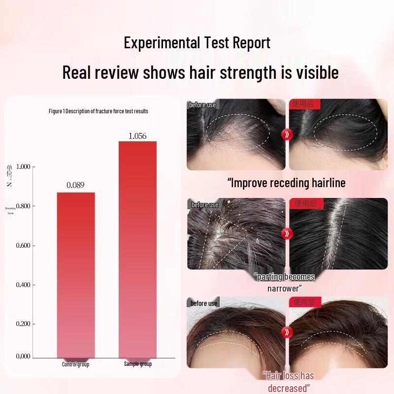 BaWang Women's Anti-Hair Loss & Nourishing Shampoo