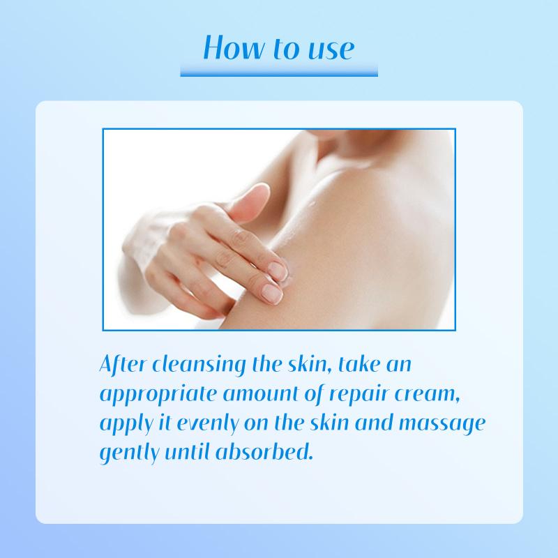 Repair Treatment Cream Exfoliating Removal Chicken Skin Cleaning Acne Spots Moisturizing Smooth Body Skin Care