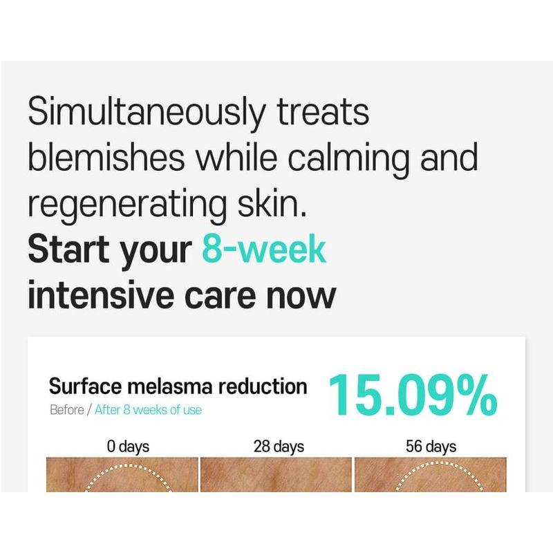 CARE:NEL - Anti-Melasma Cica Intensivserum