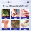 Layanana Potassium Permanganate Foot Treatment Solution