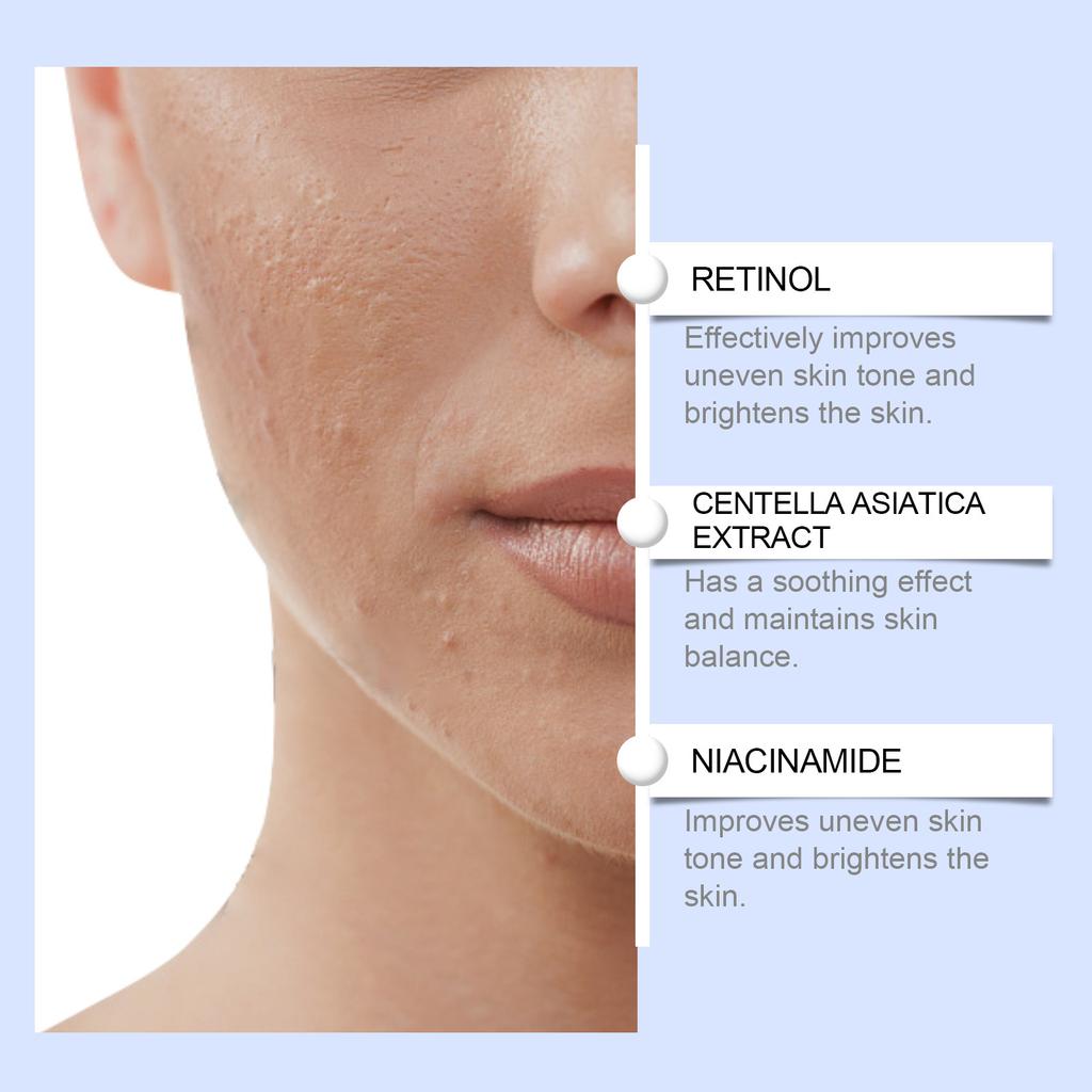 Whitening Serum;Facial Serum,Deep Moisturizing And Long-lasting Care For The Skin,30ml