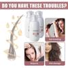 (3Pcs) H-Regrow 2.0 - Hair Regrowth for Women, H-Regrow 2.0 2025 New Formula, 50ml Hair Regrowth Rice Nutri Spray for Thinning Hair