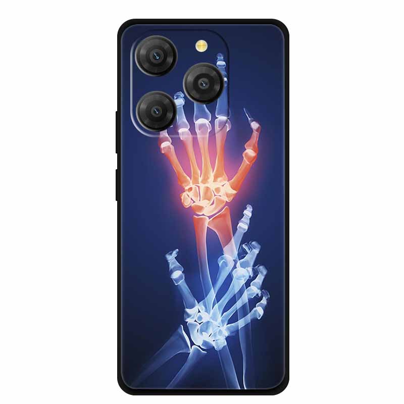 Για θήκη Blackview Shark 9 Shark9 Coque 6.67" Μαύρη Σιλικόνη Μαλακό Πίσω Κάλυμμα Θήκη Για θήκες τηλεφώνου Blackview Shark 9 Αντικραδασμική