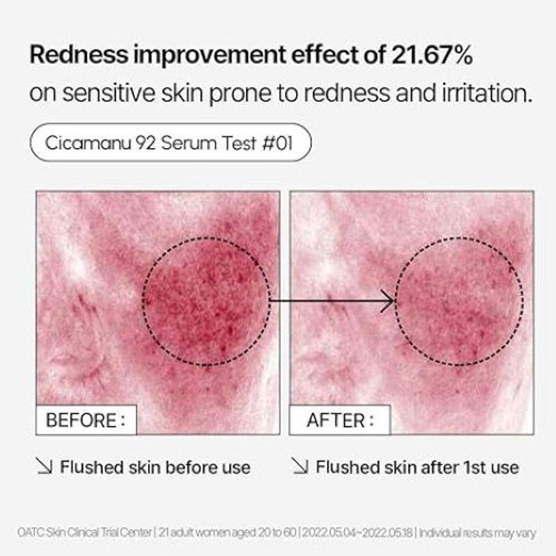 [PARNELL] *renewal* Cicamanu 92 Serum 30ml