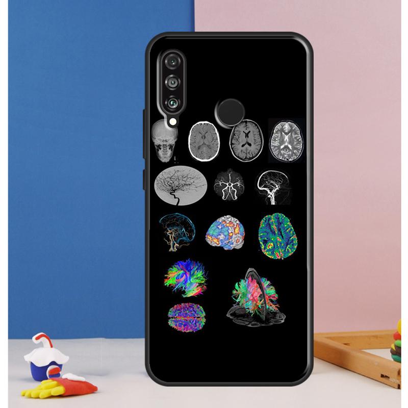 Medical Human Organs Brain Case For Huawei Nova 10 9 SE 8i 11i 12i 12s Y60 Y61 Y70 Y90 Y72 Y73 Y91 P60 Pro P30 P40 Lite