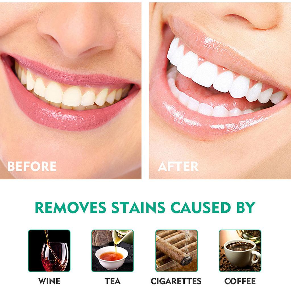 For Teeth Whitening Teeth Whitening Kits Teeth Color Corrector Toothpaste Teeth Stain Remover Color Corrector Purple Tooth Powder Teeth Whitener