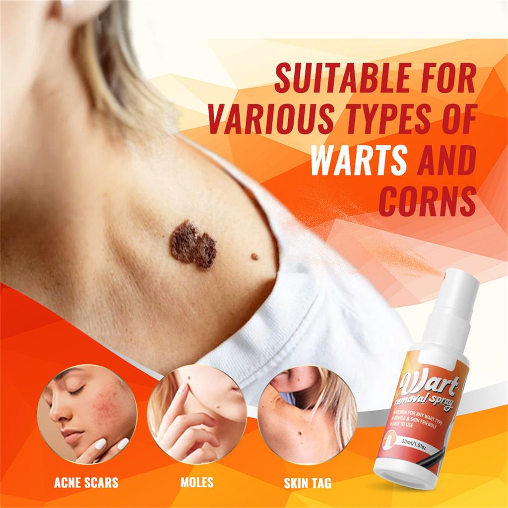 Skin  Removal Spray 30ml, Fast-acting, Long-lasting Relief, Herbal Skin Care  Removal Spray