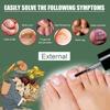 Eelhoe 15ml Toenail Treatment Liquid For Fungal Infections Strengthening Softening