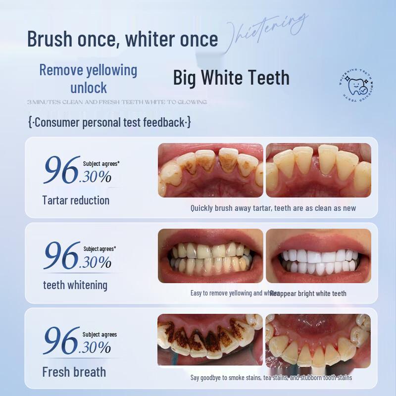 OSXE German Imported Whitening Toothpaste