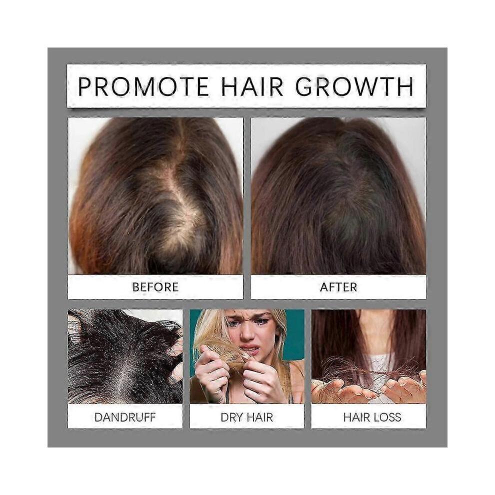 1-3pcs Hair Serum - Revitalize Follicles, Moisturize Scalp & Promote Growth 60ml