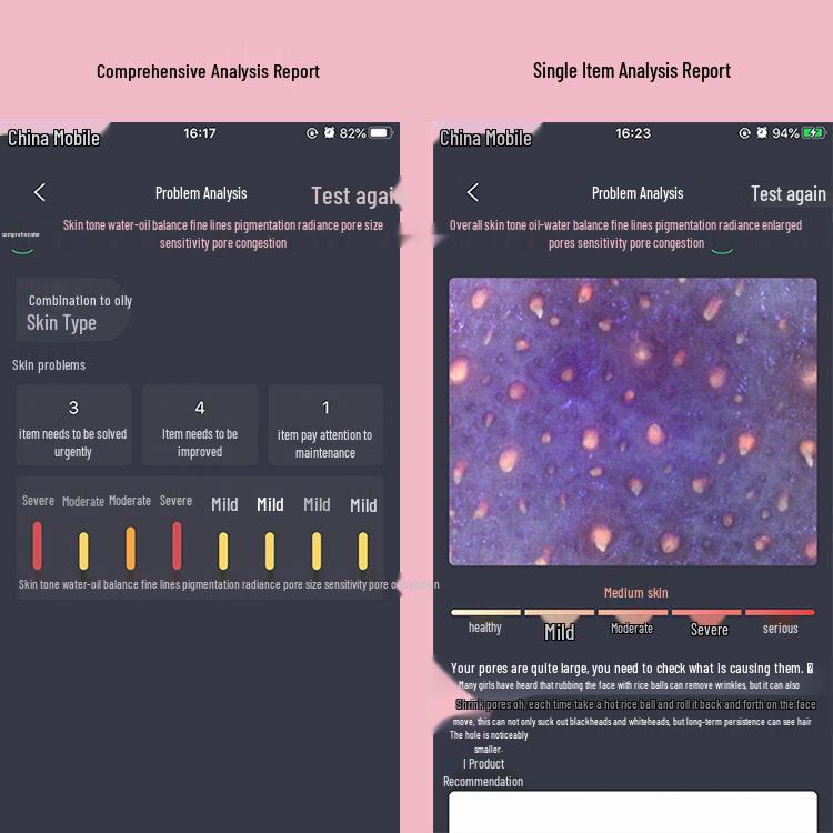 JHOT Wireless WiFi Magic Mirror Skin Analyzer: Three-Spectrum Epidermis, Dermis, UV Tester