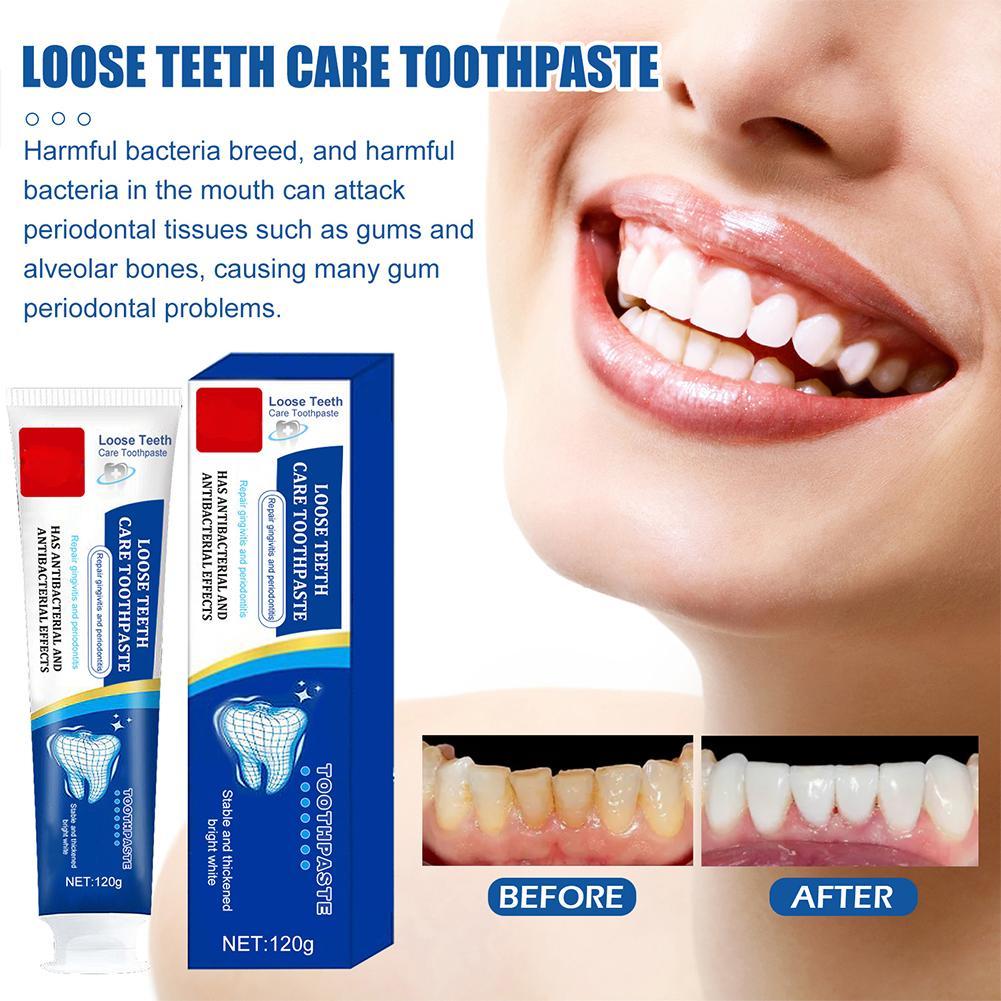 Quick Repair of Cavities Teeth Whitening Toothpaste Removal of Plaque Stains Decay Fresh Breath Repair Teeth Care Product 100g