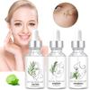 Facial  Set With Peppermint TeaTree And Rosemarys  3pc3*30ml  Skin  To Tighten Pores