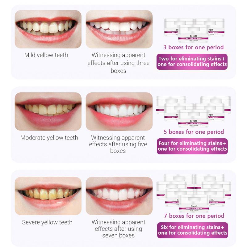 RtopR Teeth Whitening Powder Gentle Activated Mint Extract Teeth Whitening Natural Teeth Bleaching