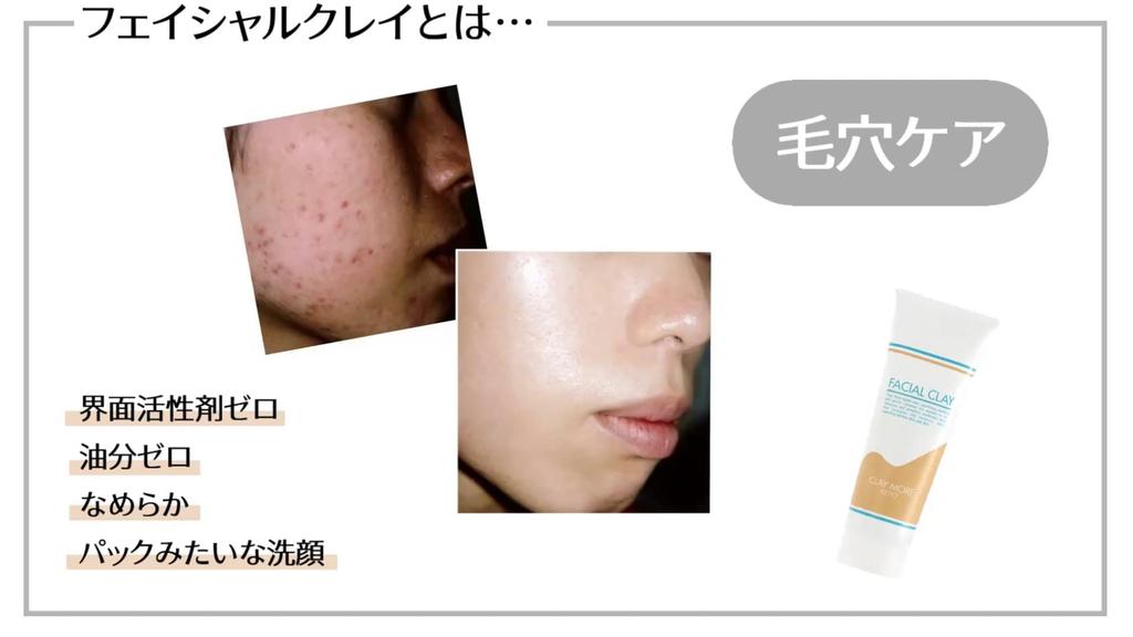 Claymore Kate Facial Clay Clay Facial Cleanser Clay Facial Cleanser Clay Facial Pack Facial Cleanser Clay (280g)