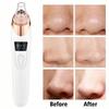 Facial Pore Cleaner, 5 Suction Power Blackhead Remover Pore Vacuum - USB Rechargeable Facial Pore Cleaner Kit