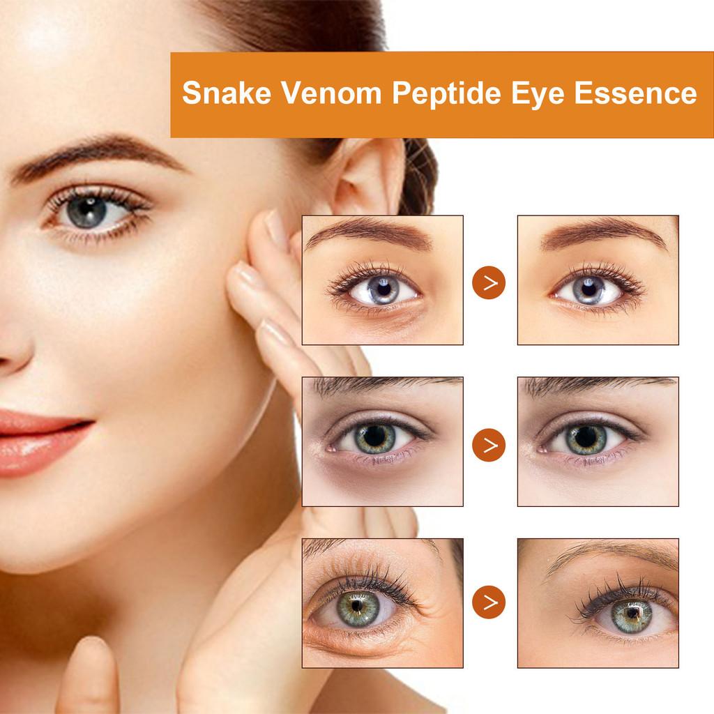 Ouhoe Anti-wrinkle Eye Serum 30ml For Firm Skin Reduces Fine Lines And Dark Circles