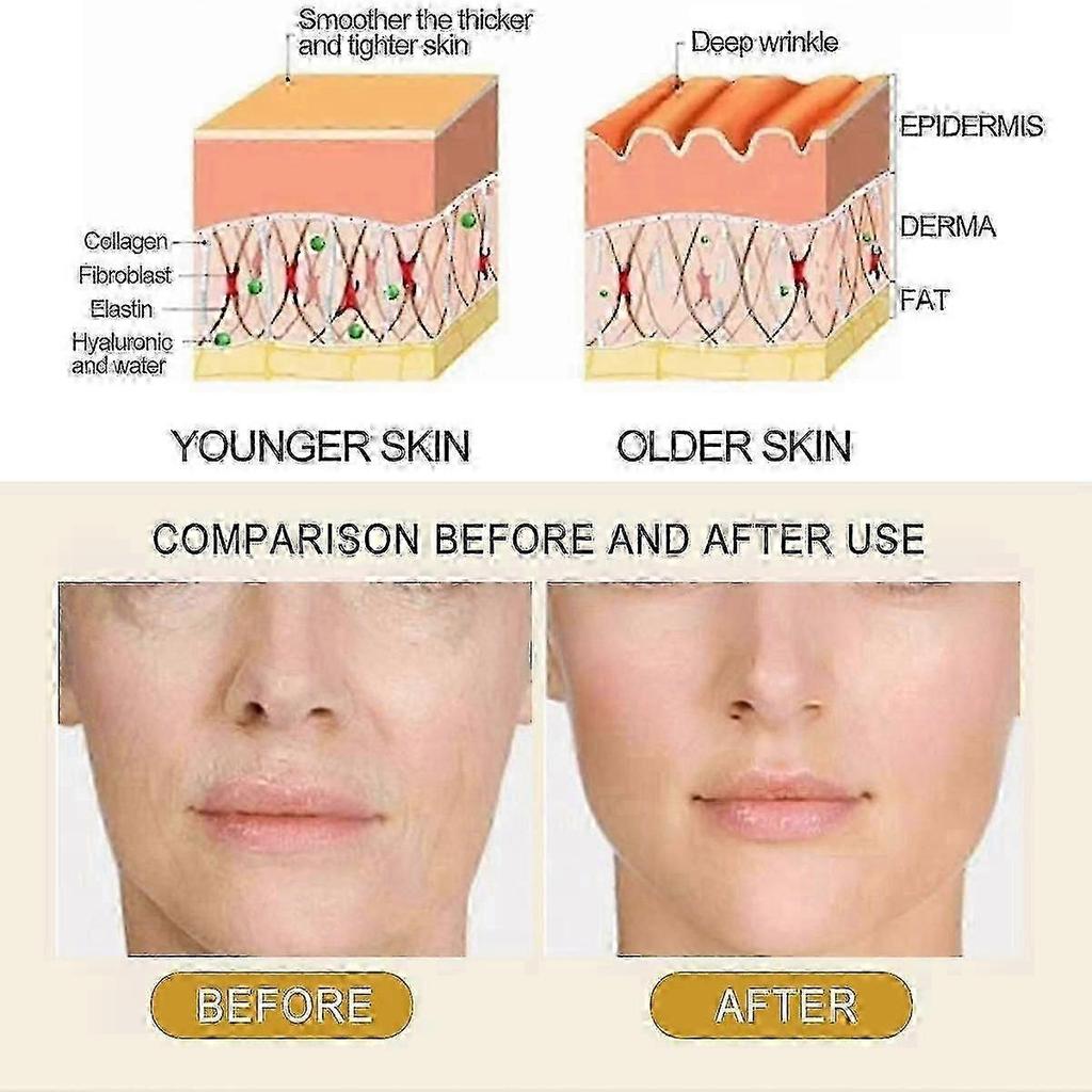 EELHOE Collagen Essence Improves Facial Skin, Lightening Fine Lines, Hydrating, Firming And Anti-Wri
