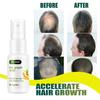 EELHOE Hair Growth Spray Essential Fast Regrowth Serum Beard Growth Oil Hair Loss Care Beauty Hairline Scalp Treatment for Men Women