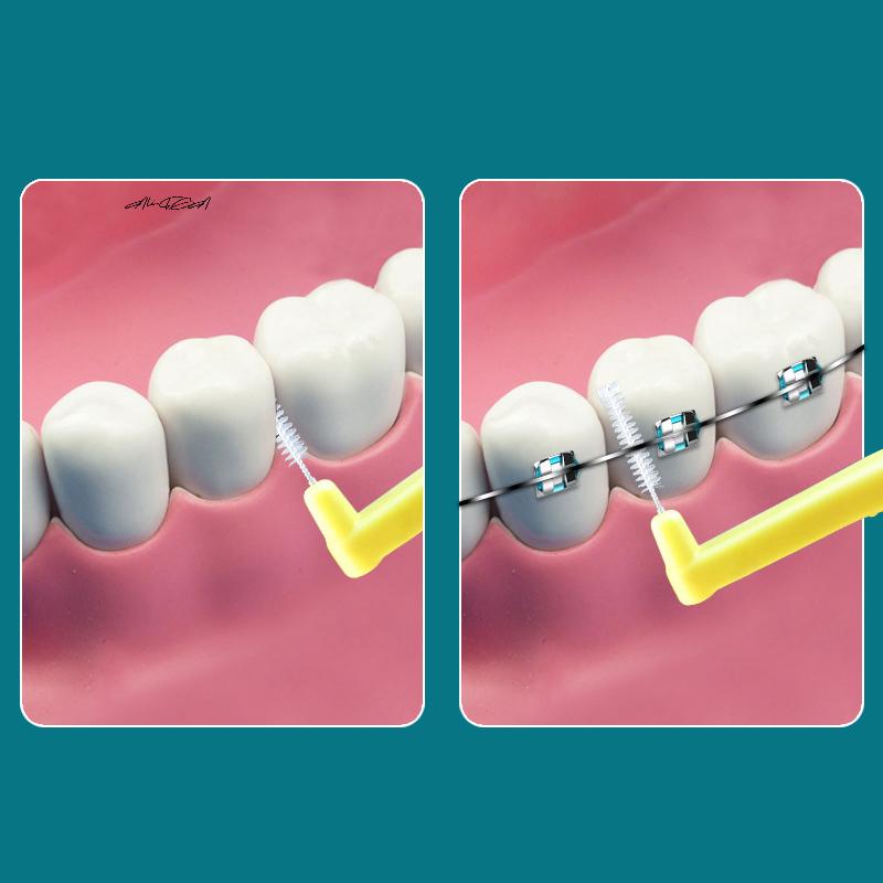 10Pcs Orthodontic Interdental Brushes Steel Wire Push-Pull Toothbrush for Oral Hygiene Food Remover Whitening Cleaner