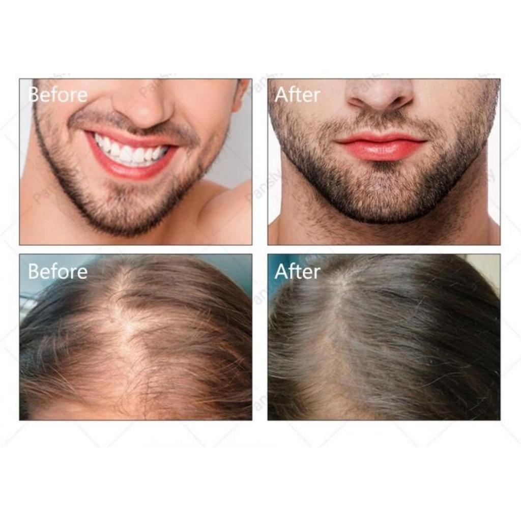 5ML/15ML/30ML/50ML/tekutina na růst řas Vyživující tekutina na růst obočí a vlasů rychle a přirozeně obohacuje živiny