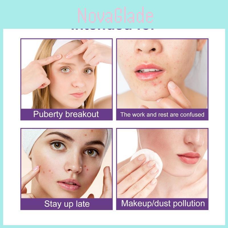Eelhoe Pimple Patches For Effective Skin Repair And Acne Spot Treatment With 180 Pieces For Clear Complexion