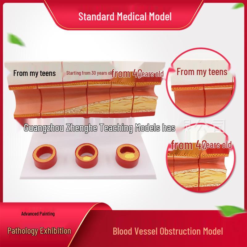 Thrombosis and Atherosclerosis Cardiovascular Model with Age-Related Artery Hardening 22x15x17 cm