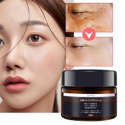 DryMartine Whitening Spot Removal Cream Altersflecken Sommersprossen Hautunreinheiten Pigmentflecken-Verbesserungscreme, 50 g, 1 Einheit